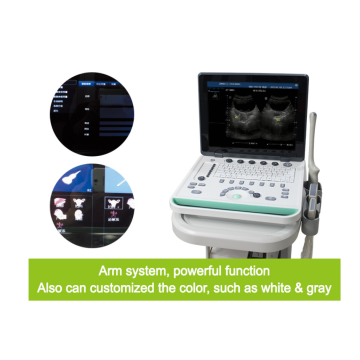 Laptop de máquina de ultra-som para clínica